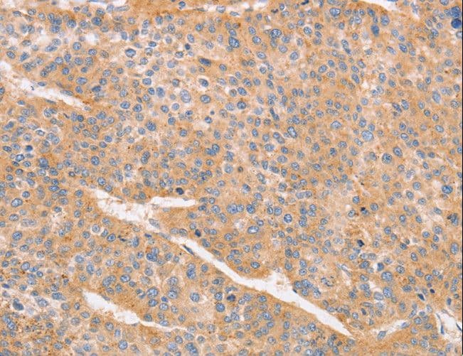 CD2AP Antibody