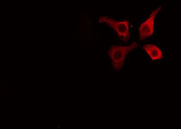 CAV1 / Caveolin 1 Antibody (phospho-Tyr14)