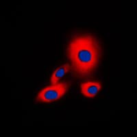 Polyclonal Rabbit anti-Human YWHAZ / 14-3-3 Zeta Antibody (phospho-Ser58, IHC, IF, WB)