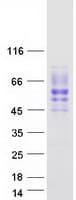 Human SIGIRR Protein (Recombinant Myc-DDK (Flag))