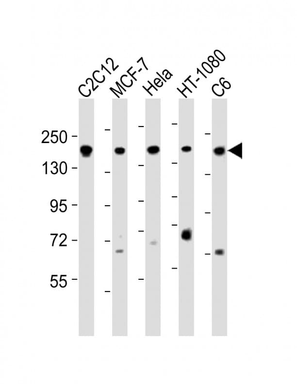 ROCK2 Antibody (aa1040-1073)
