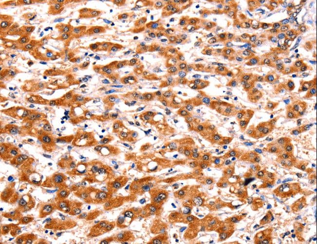 FBLN1 / Fibulin 1 Antibody