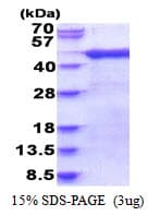 Human ARFIP1 Protein (Recombinant His)