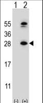 Polyclonal Rabbit anti-Mouse DHFR Antibody (aa135-164, IHC, WB)