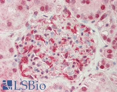 RTCB / C22orf28 Antibody (aa107-156)