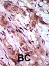 Polyclonal Rabbit anti-Human AURKC / Aurora C Antibody (Lys255, IHC, WB)