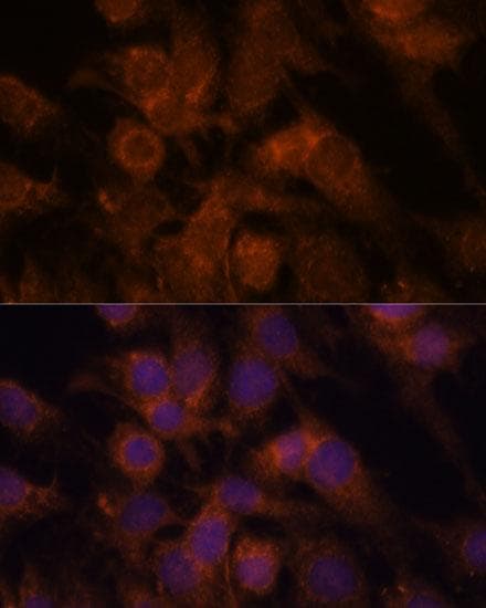 SEC23IP / p125 Antibody