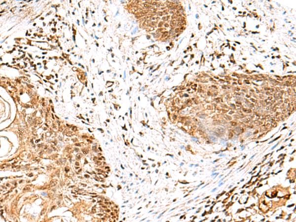 GMPPB Antibody