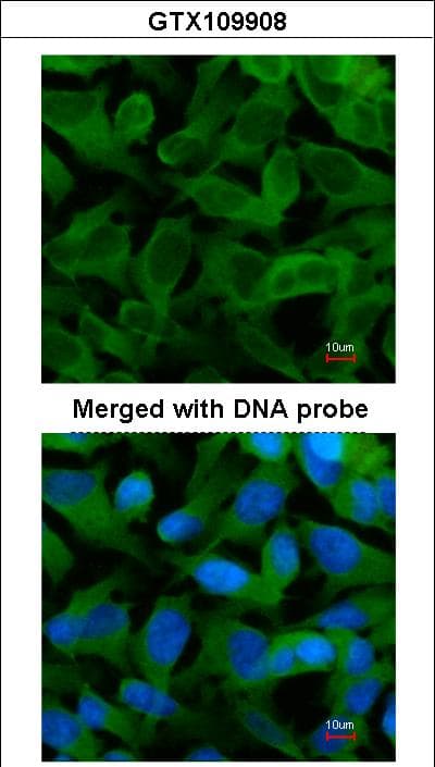 CCT5 / TCP1 Epsilon Antibody (aa1-264)