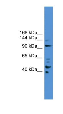 PIBF1 / PIBF Antibody (aa601-650)