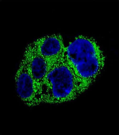 Polyclonal Rabbit anti-Human AMACR / P504S Antibody (aa323-351, IHC, IF, WB)