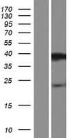 PRR20D Protein (Over-Expression Lysate Myc-DDK (Flag))