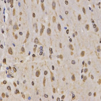 Histone H3 Antibody (Methyl-Lys4)
