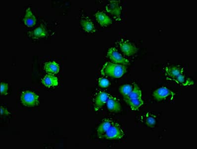 Polyclonal Rabbit anti-Human SPIRE2 Antibody (aa79-388, IHC)