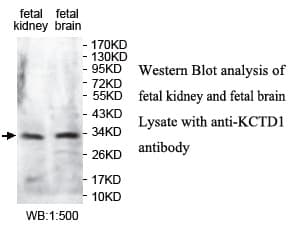 Polyclonal Rabbit anti-Human KCTD1 Antibody (aa47-228, WB)