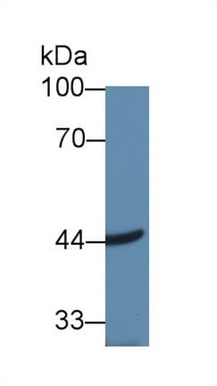 ACAA2 Antibody (APC)