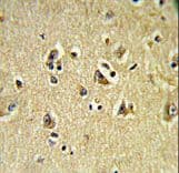 HCCS1 / VPS53 Antibody (aa111-140)