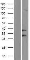 HFE Protein (Over-Expression Lysate Myc-DDK (Flag))