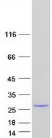 Human LTA / TNF Beta Protein (Recombinant Myc-DDK (Flag))