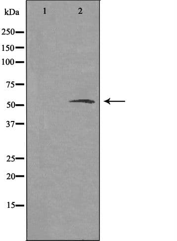 HTR2B / 5-HT2B Receptor Antibody