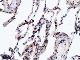 EPHX2 / Epoxide Hydrolase 2 Antibody (clone OTI1H5)