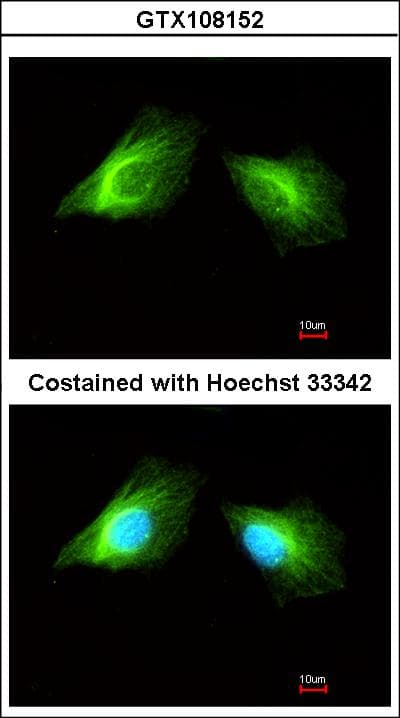 Polyclonal Rabbit anti-Human HRH2 / Histamine H2 Receptor Antibody (aa1-45, IHC, WB)