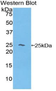 HBB / Hemoglobin Beta Antibody (aa1-145)