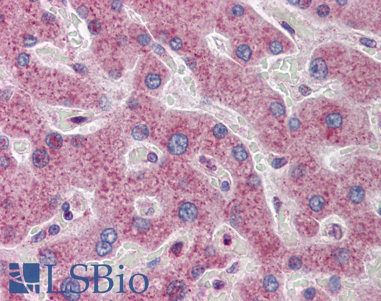 ATF5 Antibody (aa101-150)