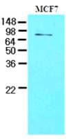 IHC-plus™ TDP1 Antibody (clone AT1F2)