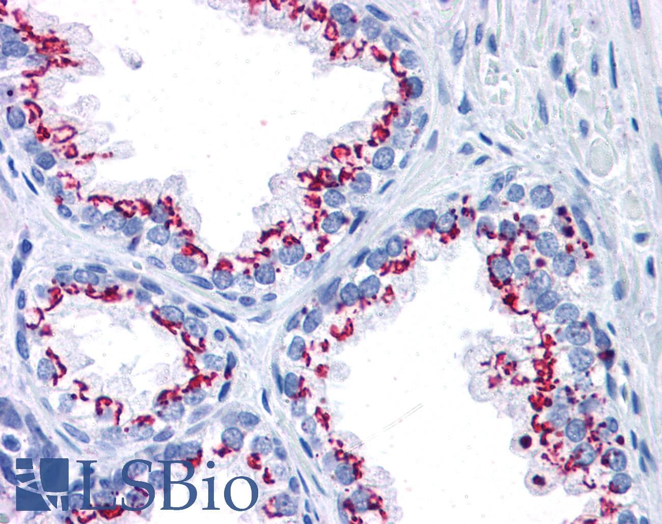 IHC-plus™ GOLM1 / GP73 / GOLPH2 Antibody (aa389-401)
