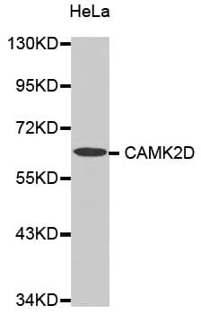 CAMK2D / CaMKII Delta Antibody