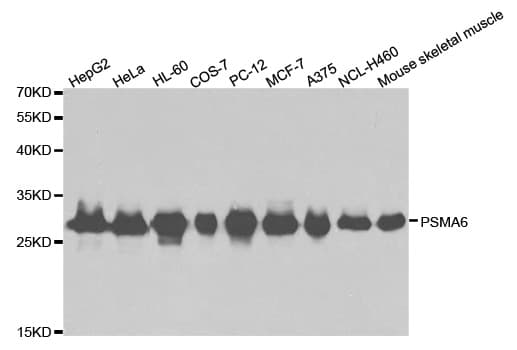 PSMA6 Antibody