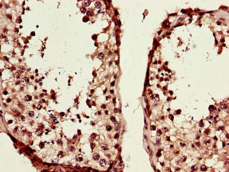 TCF3 / E2A Antibody