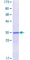 Human MKRN3 Protein (Recombinant GST, N-terminus)