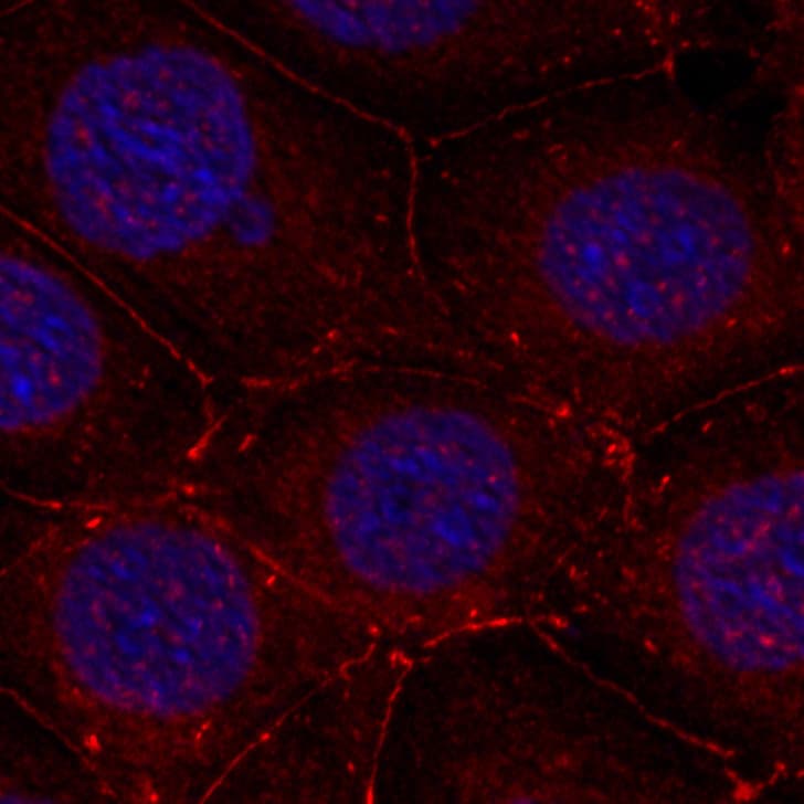 IGF1R / IGF1 Receptor Antibody (phospho-Tyr1161)