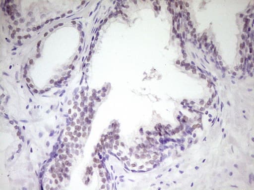 HIPK1 Antibody (aa439-697, clone OTI5F1)