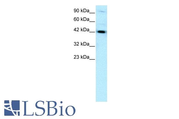 HNF1B / HNF1 Beta Antibody (aa43-92)