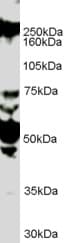 IHC-plus™ ROBO1 Antibody (aa994-1006)