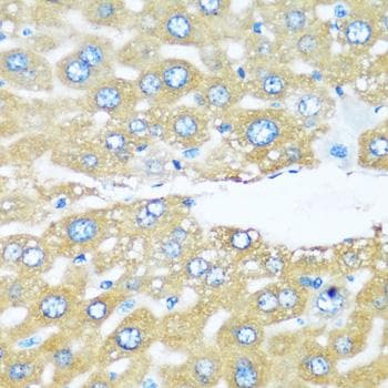 Polyclonal Rabbit anti-Human ARHGEF5 Antibody (IHC)
