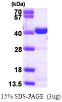Human CRKL Protein (Recombinant His)