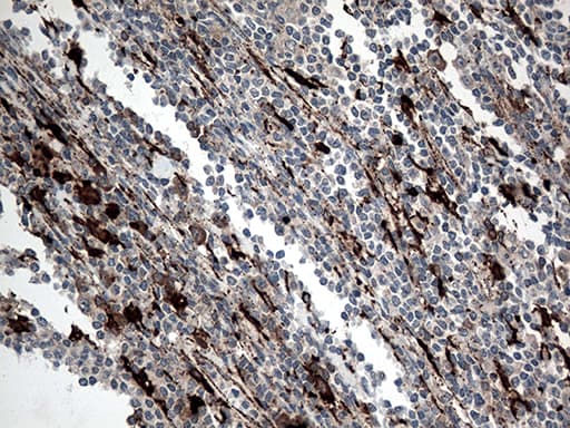 CTSL / Cathepsin L Antibody (aa114-333, clone OTI6D5, Carrier-free)
