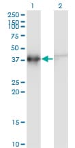 ACTRT2 Antibody (clone 2E10)