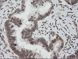 ZSCAN18 / ZNF447 Antibody (clone OTI2H7, Carrier-free)
