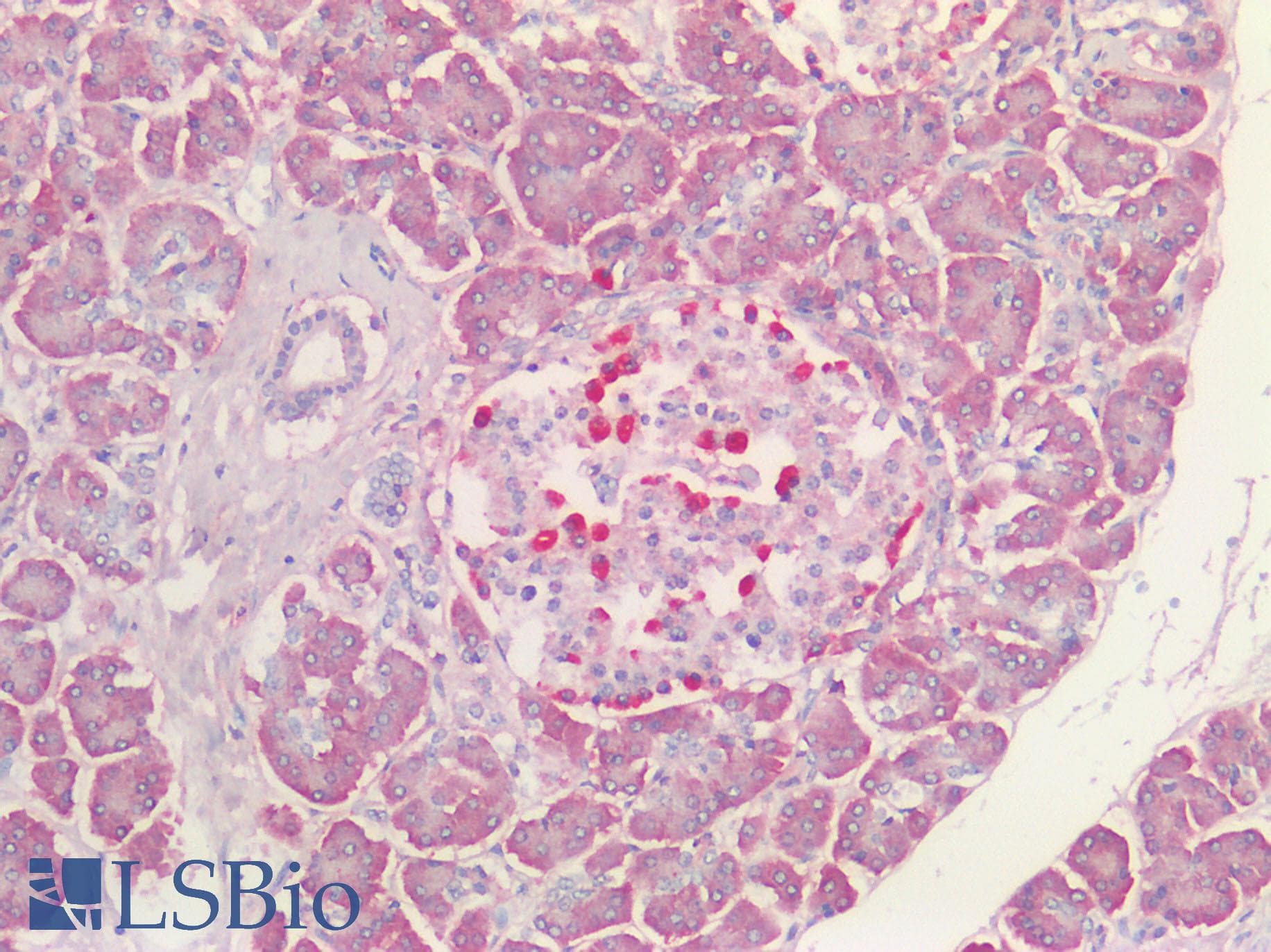 IHC-plus™ VPS35 Antibody (Internal Region)