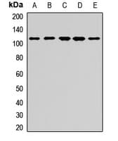 Polyclonal Rabbit anti-Human EXOC4 / SEC8 Antibody (WB)