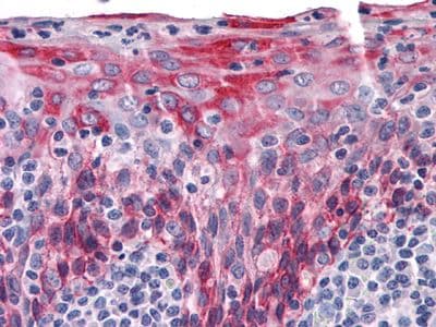 KRT15 / CK15 / Cytokeratin 15 Antibody (clone 60000000)