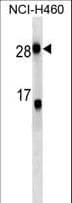Monoclonal Mouse anti-Human CRP / C-Reactive Protein Antibody (aa8-35, WB)
