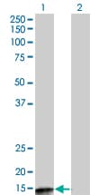 PPP3R2 Antibody (clone 5D9)