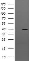 MAP2K3 / MEK3 / MKK3 Antibody (clone OTI5C4, Carrier-free)