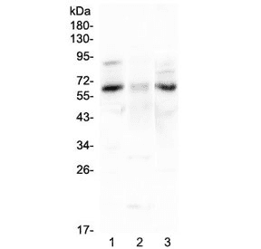 CCKBR / Cckb Antibody
